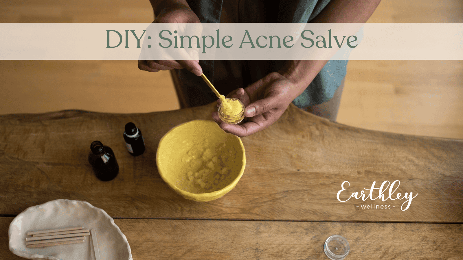 Earthley Acne Salve 2oz amber jar with green tea label for natural blemish treatment and oily skin support