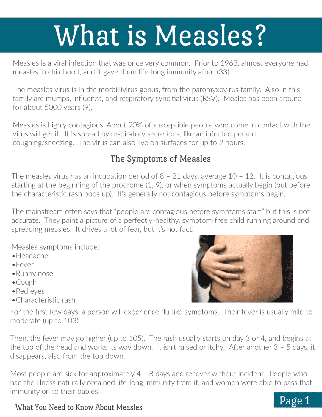 what you-need-to-know-about-measles-109940
